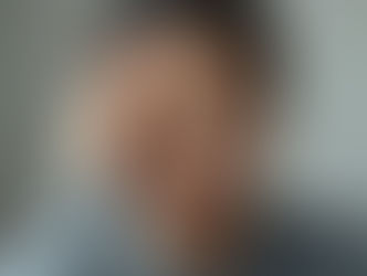 「頭皮の痛みに悩み、こめかみに手を当てている女性の写真」