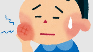 頬を押さえて歯痛に苦しむ男性のイラスト。親知らず抜歯後の痛みを表現。