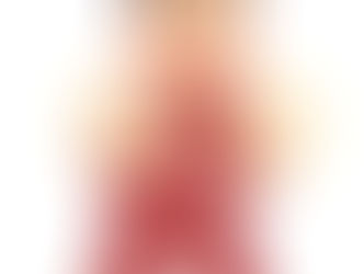 膝の痛みで階段の昇り降りが困難になった女性の症例を紹介する記事のイラスト