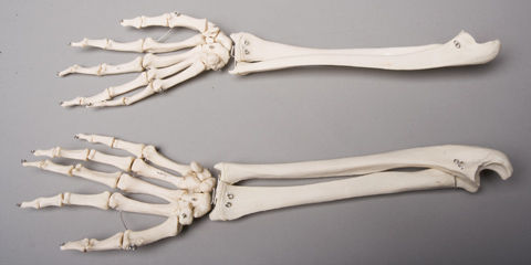 Thumbnail: Posable Skeleton Arms, Life Size, Pair, 2nd Class
