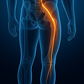 AI sciatica_edited.jpg