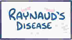 Raynaud's Phenomenon