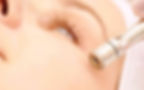 Microdermabrasion