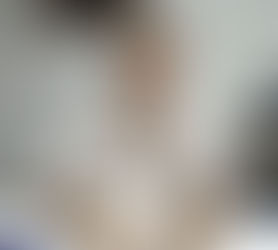 Seguridad Alimentaria
Triquinosis: Recomendaciones a consumidores para prevenir la enfermedad