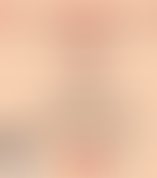 Sensibilizan a la población sobre la importancia de ‘la consulta temprana ante la aparición de fiebre y manchas rojas en la piel’