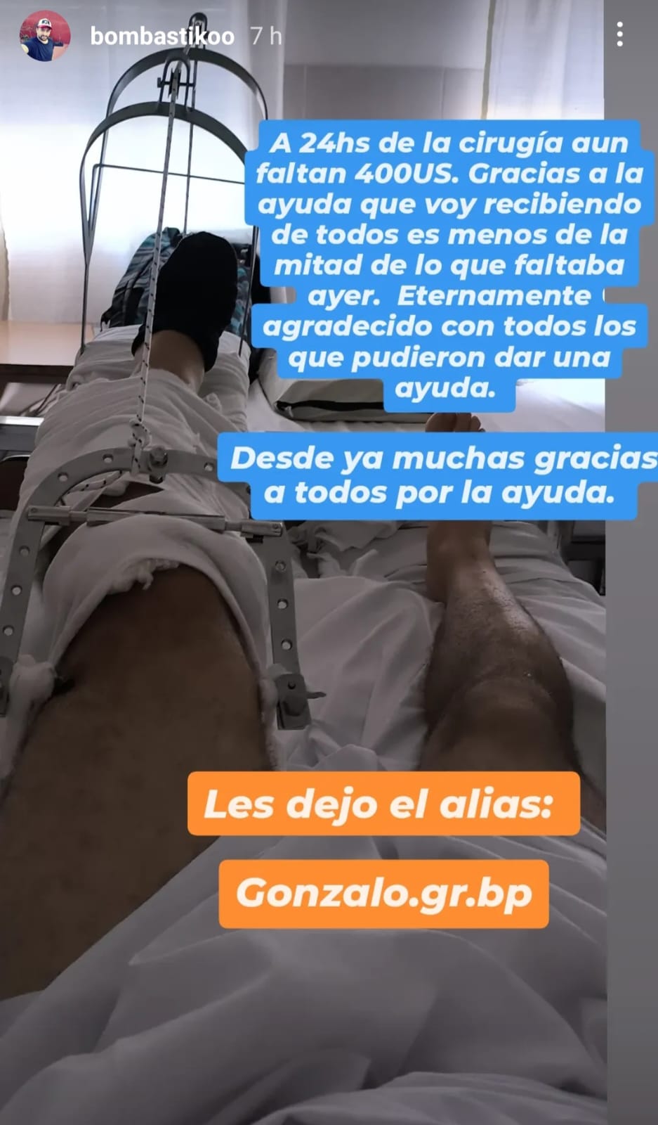 Pedido Solidario para colaborar con Gonzalo que sufrió graves lesiones al ser embestido por un menor en contramano