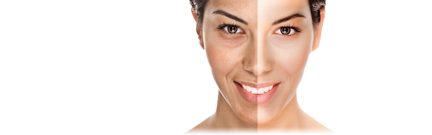 EXPECT BEAUTIFUL SKIN