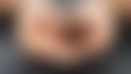 טיפול לא פולשני בנשירה