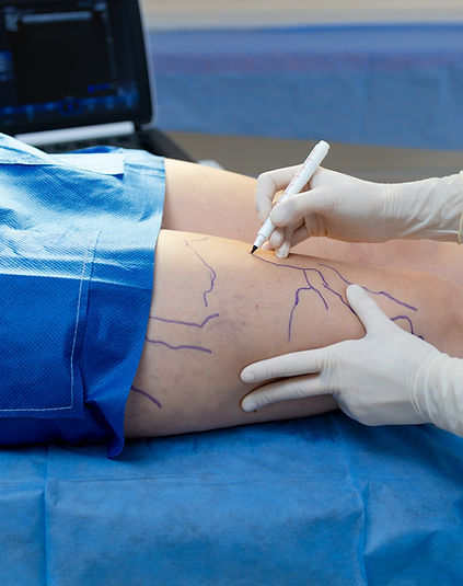 preoperative-vein-mapping-by-vascular-surgeon.jpg