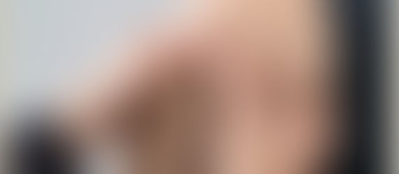 Θεραπεία γόνατος rebouteux : Τεχνικές rebouteux για τους πόνους στο γόνατο