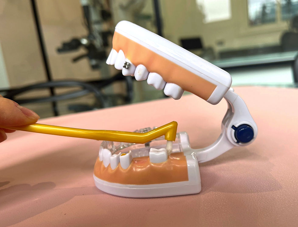 Model of teeth demonstrating yellow interspace brush to clean wisdom tooth area