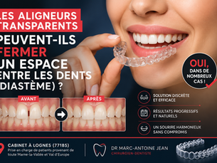 Les aligneurs transparents peuvent-ils fermer un espace entre les dents (diastème) ?