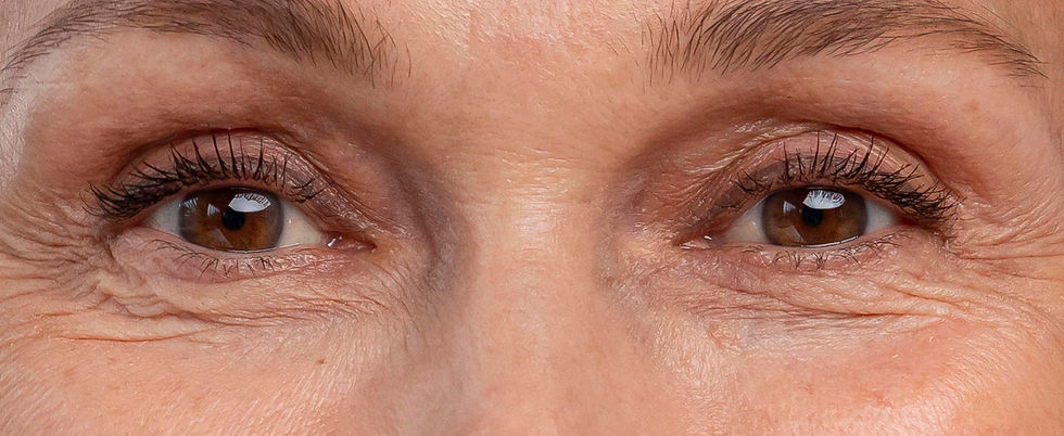 antiaging-beauty-treatment2.jpg