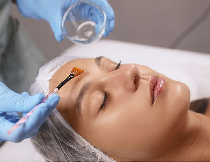 Royal Laser & Skin Care - PCA peel with hydroquinone.jpg
