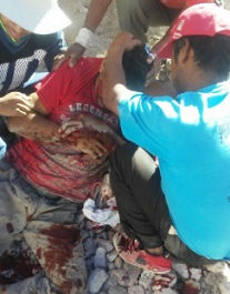 Por explosión de dinamita un hombre resulta herido en Oaxaca