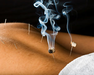 moxibustion.jpg