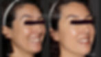 Wrinkle Relaxer