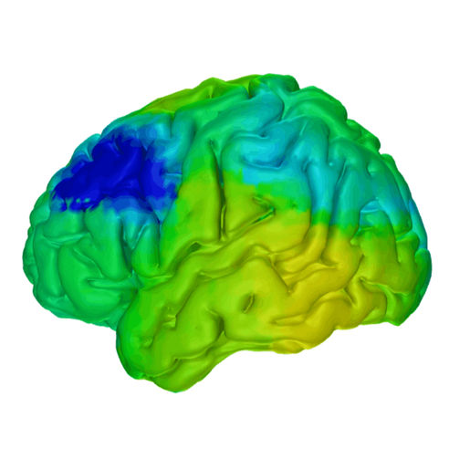 Word Finding Problems with Parkinson's and How to Fix It!