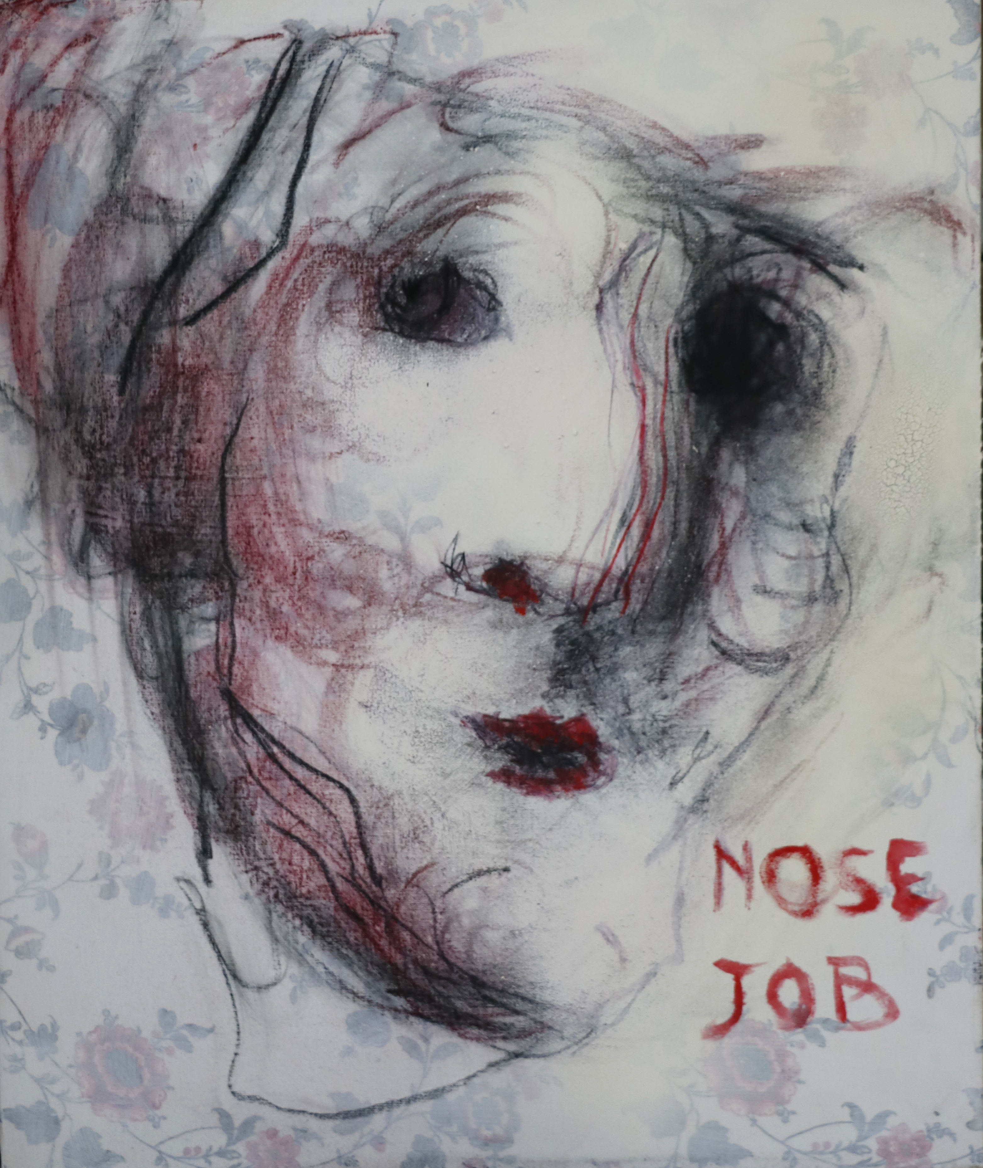 NOSE JOB
