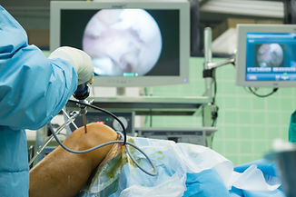 arthroscope surgery.jpg