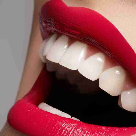 VENTAJAS Y DESVENTAJAS DEL BLANQUEAMIENTO DENTAL