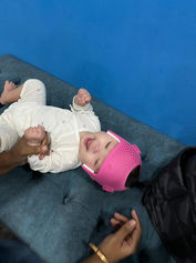 Pakar melaraskan helmet kranial pada bayi semasa rawatan plagiosefali.