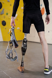 Person with an above knee prosthesis, holding a climbing harness.