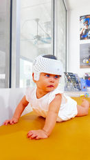 Baby crawling while wearing a cranial helmet for plagiocephaly treatment.
