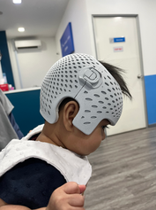 Bayi memakai ortosis pembentukan semula kranial tersuai semasa sesi pemasangan helmet.