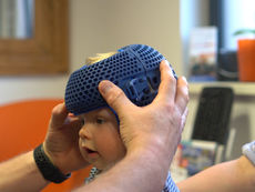 "Correcting Flat Spots: A Parent’s Guide to Baby Helmet Therapy"