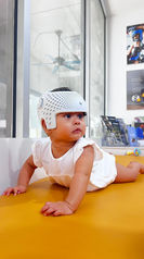 Infant playing on floor while wearing cranial helmet for flat head syndrome treatment.