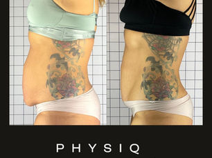 Physiq 360 vs. Other Body Contouring Devices