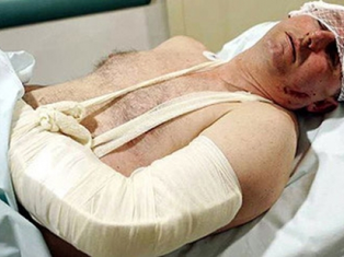 Novinare Dalmatine tuče tko stigne