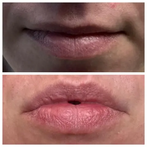Lip Flip