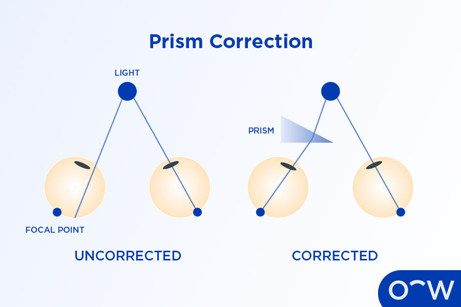 Diagram titled "Prism Correction" showing light path uncorrected and corrected with prism. Spheres and focal points are labeled; blue and yellow tones.