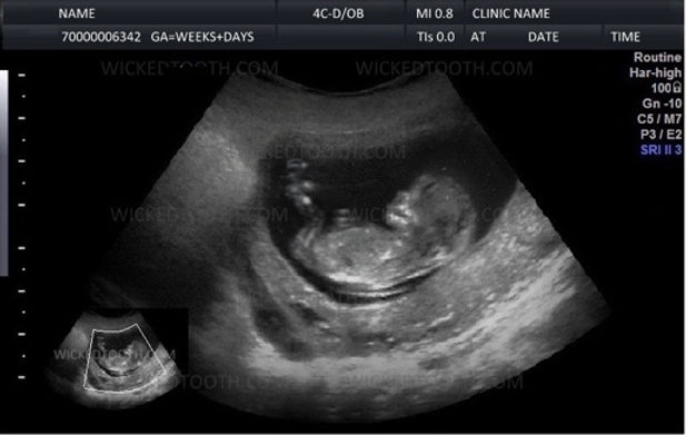 1babyscan.jpeg