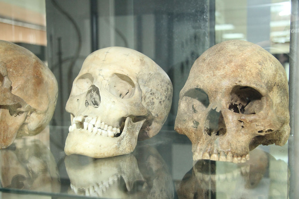 Черепа из погребений