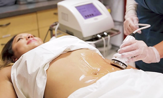 696x418_feature_utrasoniccavitation_012419_mw_jpg-696x418.jpeg