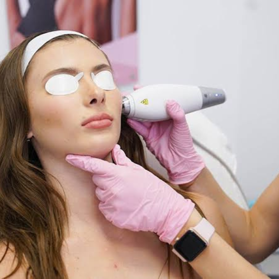 LaserAway service