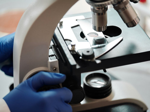 The Amazing World of Microbes: Tiny Creatures with Big Impact