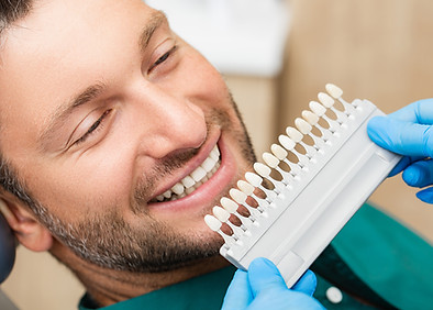 Veneers.jpg