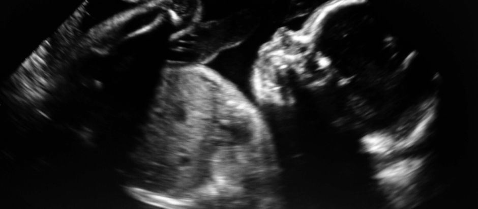 CCC Statement on Enactment of SB25-183 Abortion Financing Bill