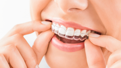 Dental Checkup
