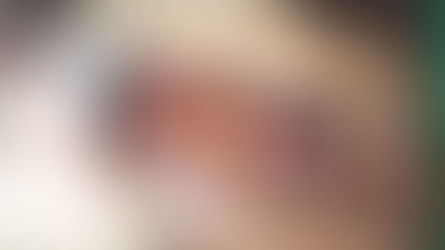 Ochorenia ústnej dutiny