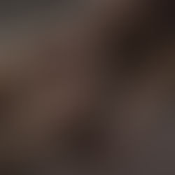 Too few antibiotics in pipeline to tackle global drug-resistance crisis, WHO warns