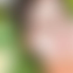 How To Guide For: Understanding Chemical Face Peels; Knowing The Pros And Cons & Products To Us