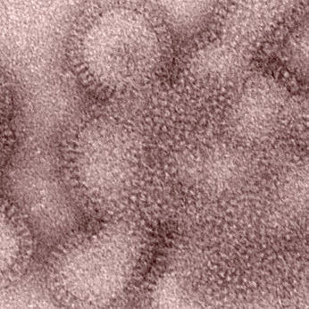 There Are So Many Flu Victims, California Hospitals Are Setting Up Emergency Tents in Their Parking 