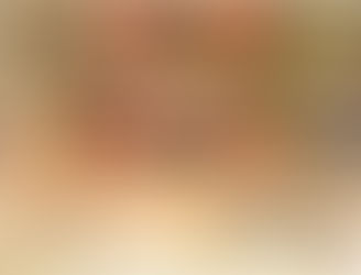 La acupuntura combate con éxito las hemorroides