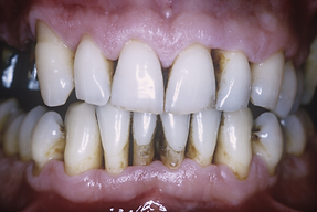 periodoncia