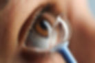 Close-up view of a scleral lens resting on an eye with keratoconus